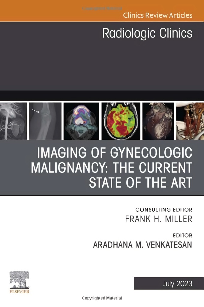 Imaging of gynecologic malignancy: the current state of the