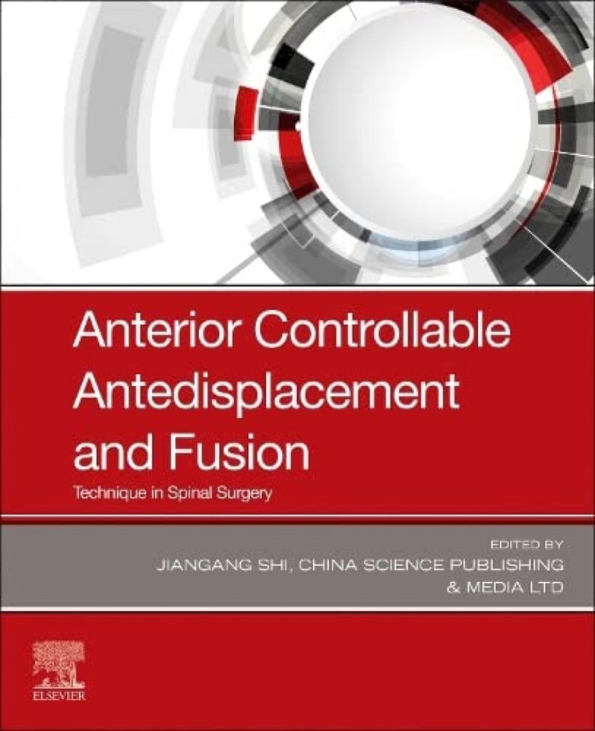 Anterior controllable antedisplacement and fusion