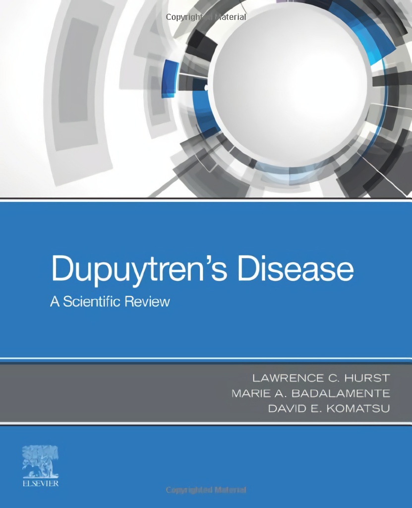 Dupuytren´s disease:a scientific review