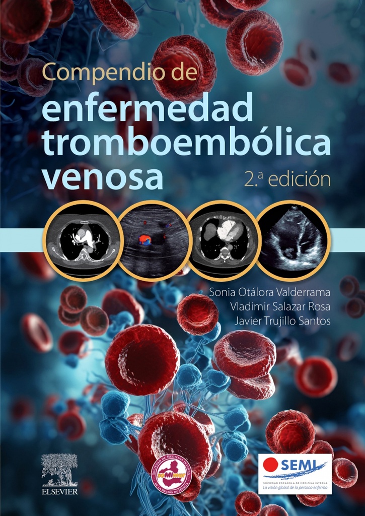 COMPENDIO DE ENFERMEDAD TROMBOEMBOLICA VENOSA 2ª ED