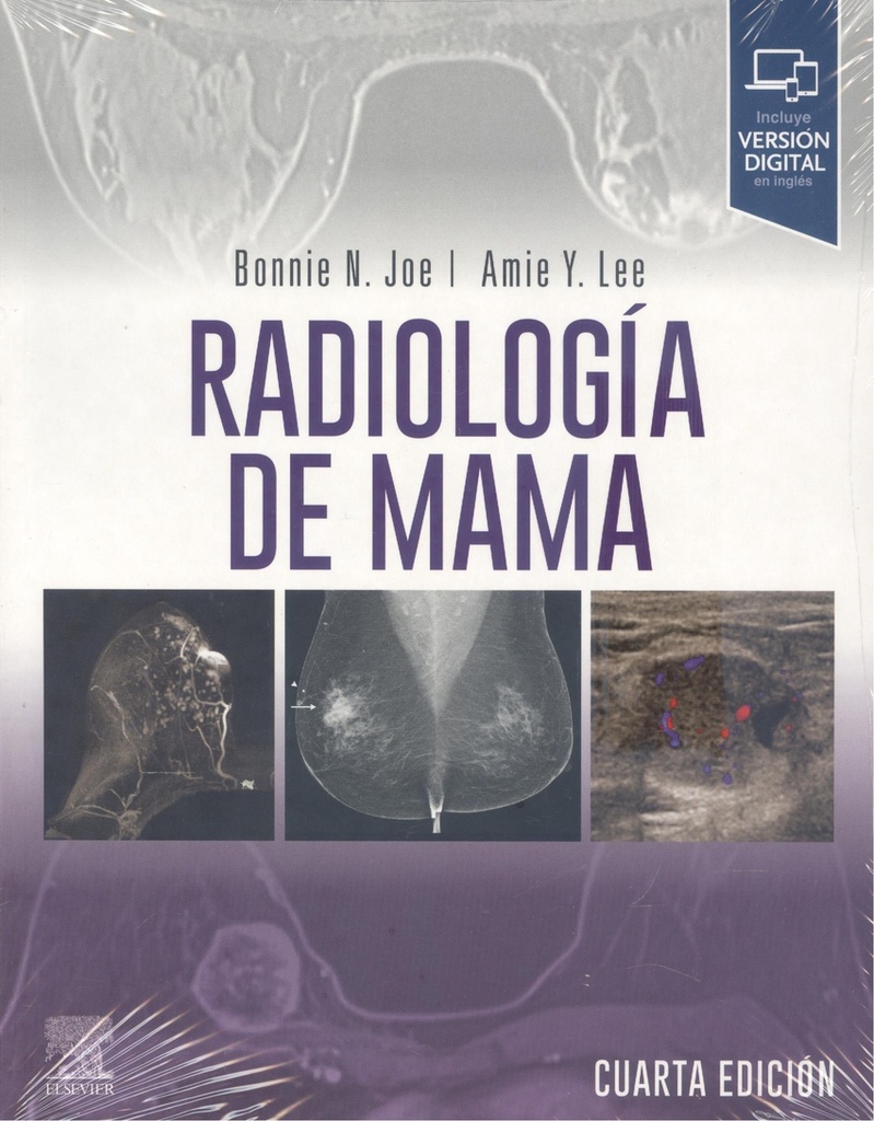 RADIOLOGIA DE MAMA 4ª ED