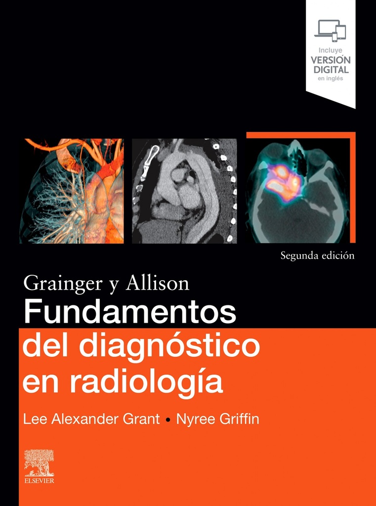 Fundamentos del diagnóstico en radiología (2ª ed.)