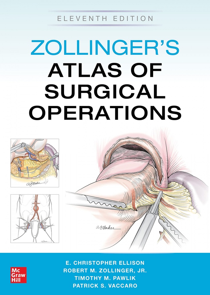 ZOLLINGER´S ATLAS OF SURGICAL OPERATIONS