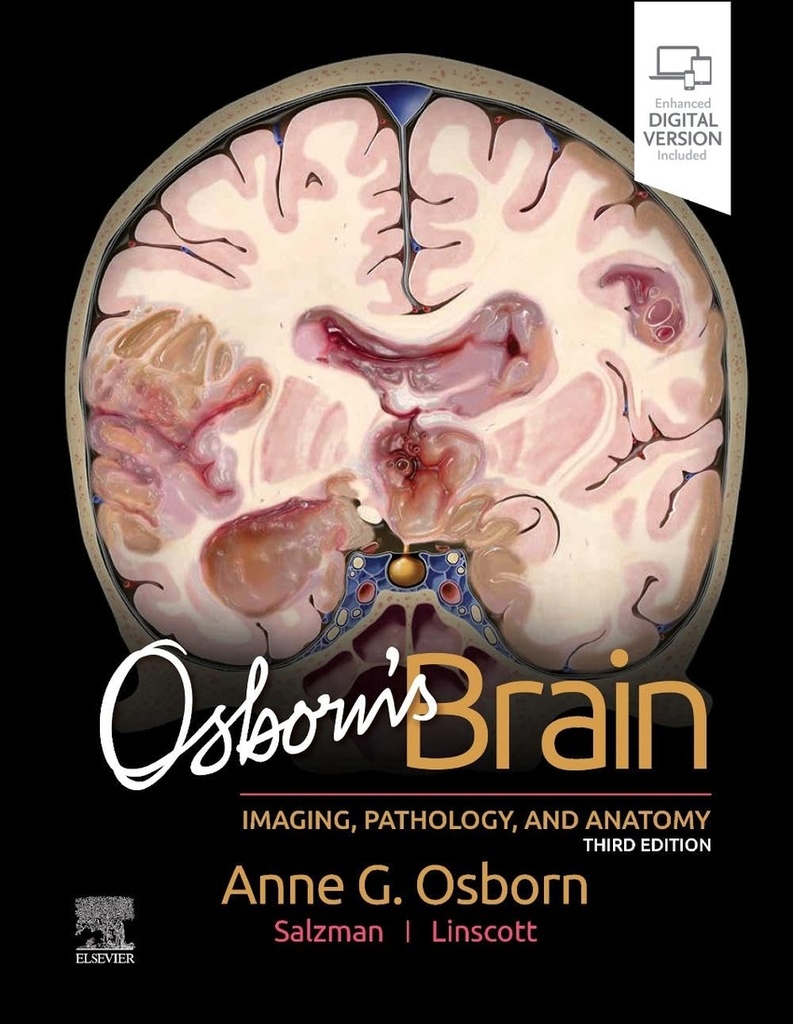 OSBORN´S BRAIN 3RD.EDITION