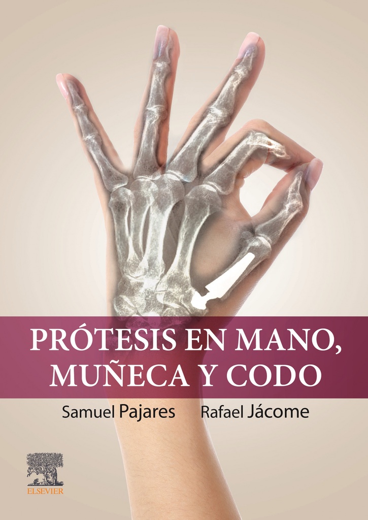 Protesis en mano muñeca y codo