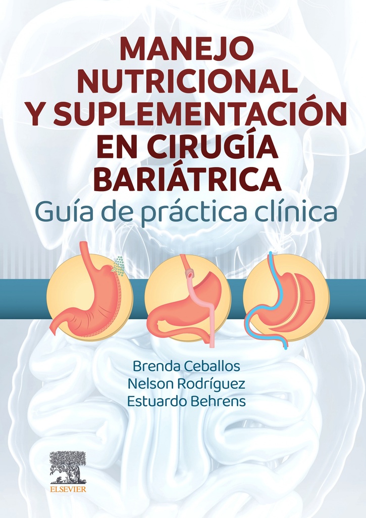 Manejo nutricional y suplementación en cirugía bariátrica