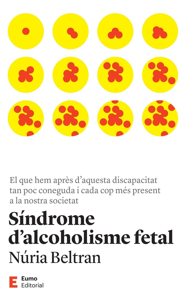 Síndrome d´alcoholisme fetal