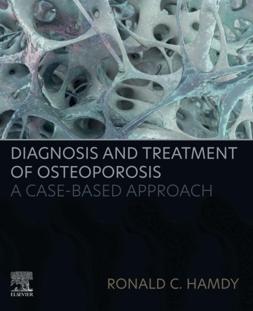 Diagnosis and treatment ofosteoporosis