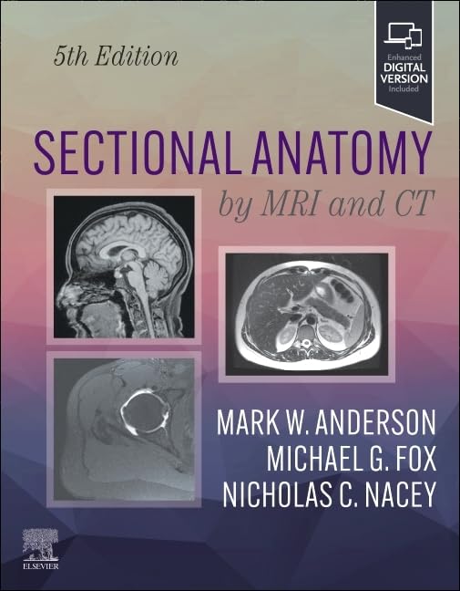 Sectional anatomy by mri and ct