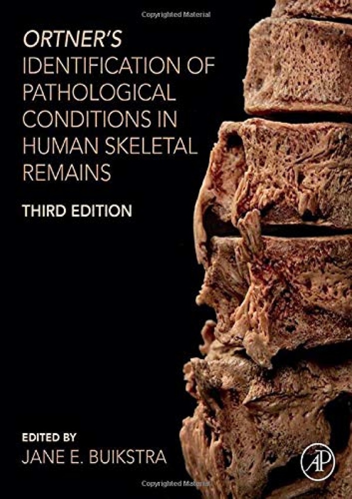 ORTNER´S IDENTIFICATION OF PATHOLOGICAL CONDITIONS HUMAN SKELETAL REIMAINS