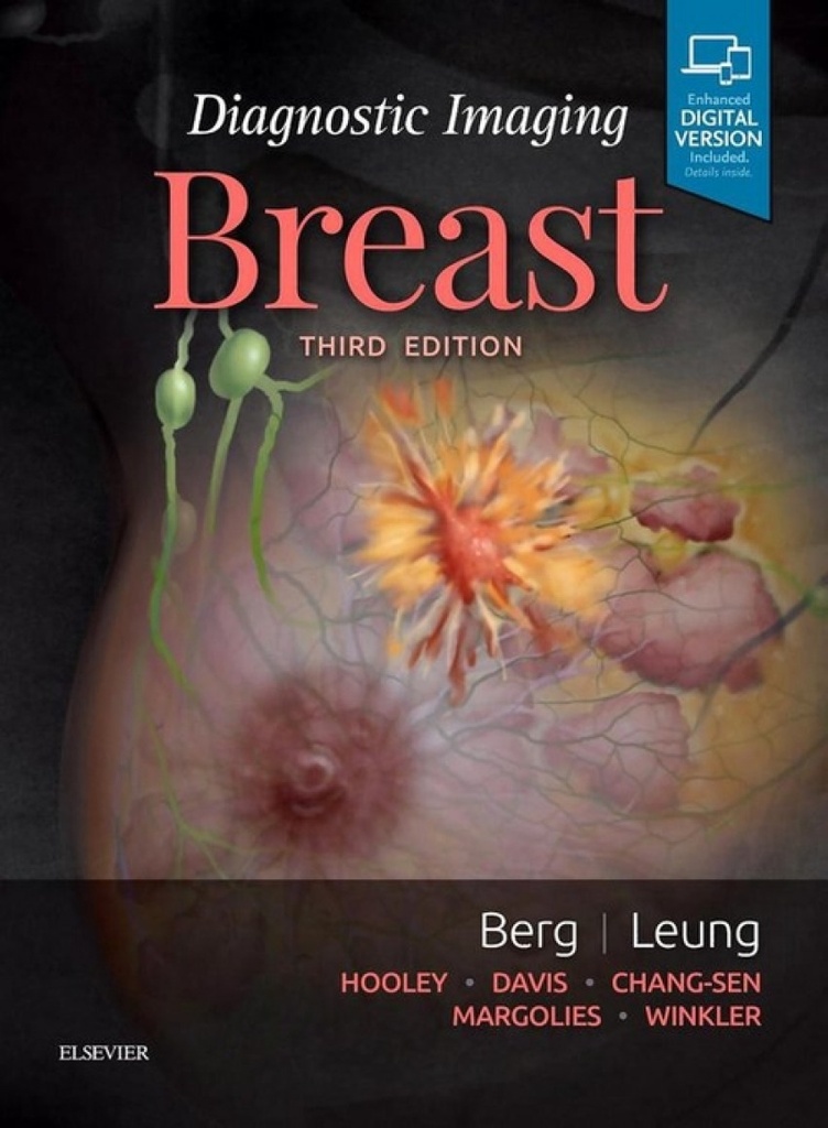 Diagnostic Imaging: Breast