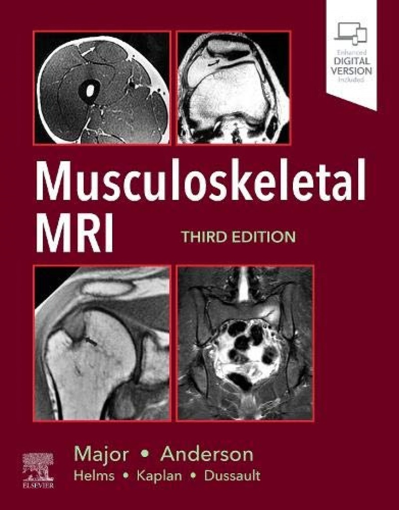 Musculoeskeletal mri