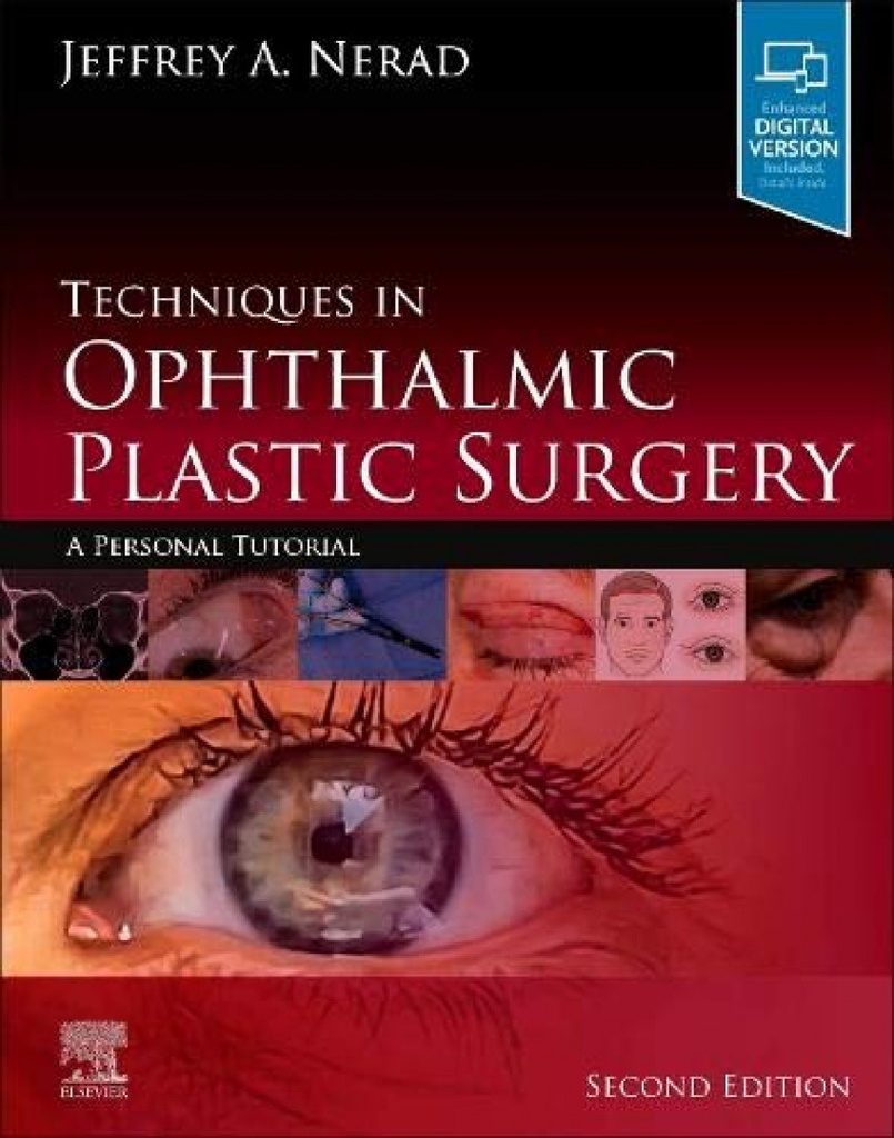 Techniques in ophthalmic plastic surgery