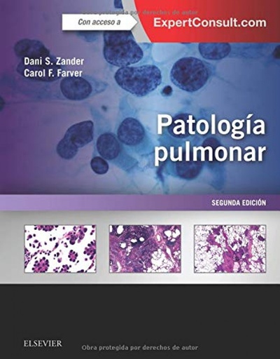 [9788491132622] PATOLOGÍA PULMONAR +EXPERTCONSULT