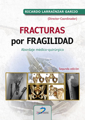 [9788490522462] Fracturas por fragilidad