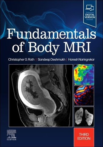 [9780323833813] Fundamentals of body mri