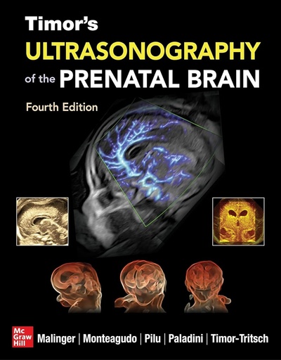 [9781260136166] TIMOR´S ULTRASONOGRAPHY OF THE PRENATAL BRAIN