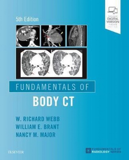 [9780323608329] FUNDAMENTALS OF BODY CT