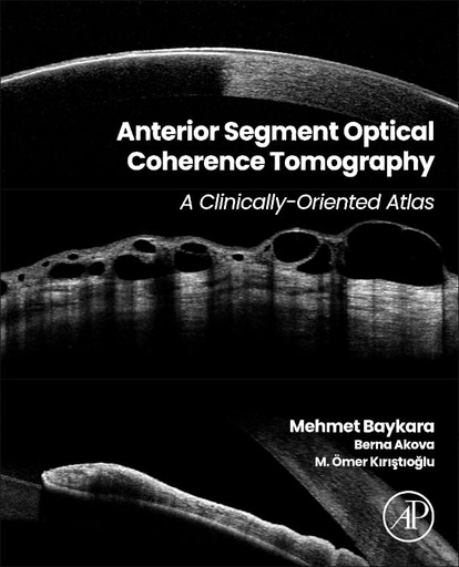 [9780443221057] ANTERIOR SEGMENT OPTICAL COHERENCE