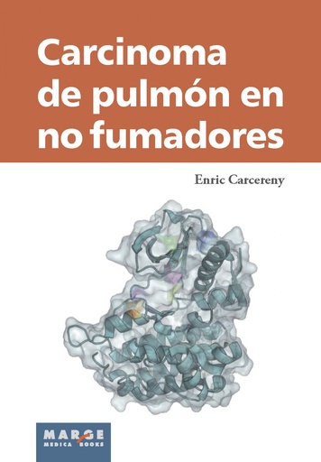 [9788415340706] Carcinoma de pulmón en no fumadores