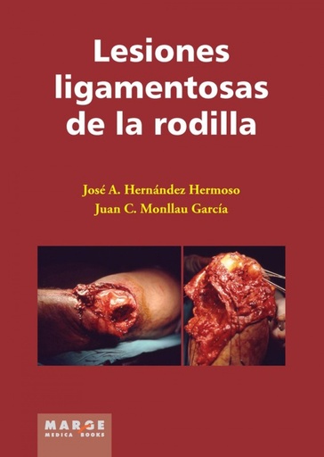 [9788415340263] LESIONES LIGAMENTOSAS DE LA RODILLA