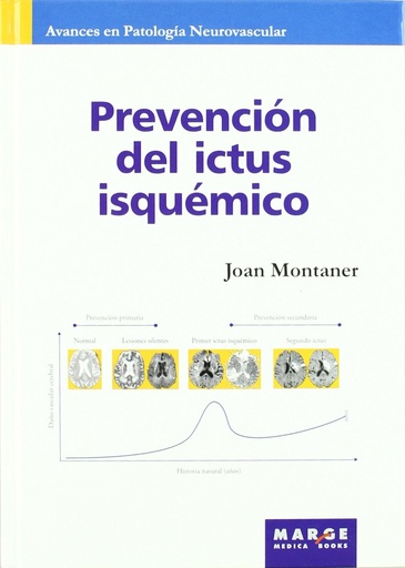 [9788492442089] Prevención del ictus isquémico