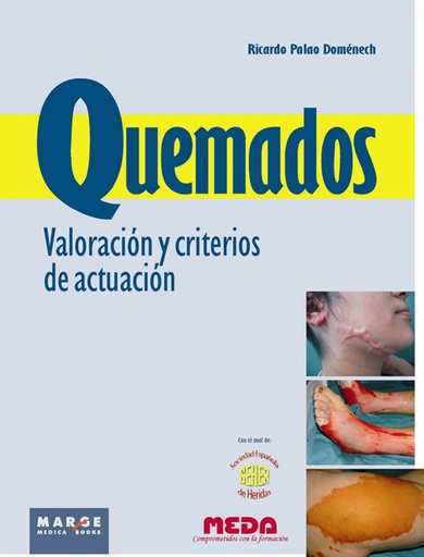 [9788415340140] QUEMADOS. VALORACION Y CRITERIO