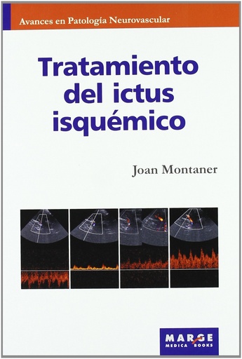 [9788492442133] Tratamiento del ictus isquémico