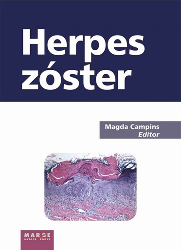 [9788492442812] Herspes Zoster