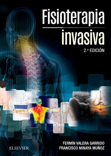 [9788491130994] Fisioterapia invasiva