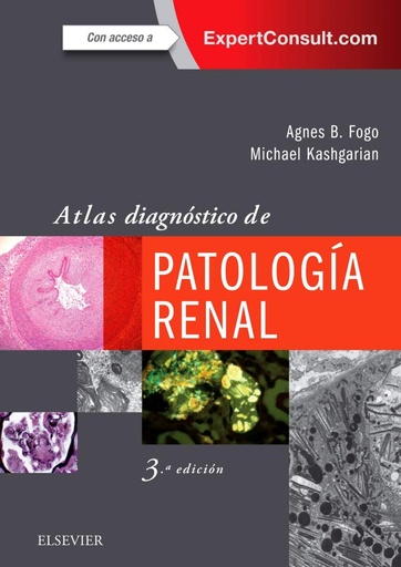 [9788491132936] ATLAS DIAGNÓSTICO DE PATOLOGÍA RENAL