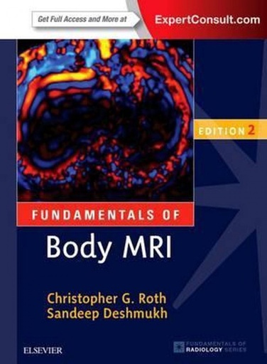 [9780323431415] Fundamentals of Body MRI