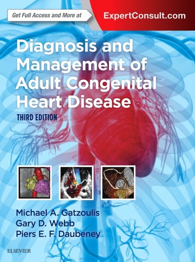 [9780702069291] Diagnosis and Management of Adult Congenital Heart Disease