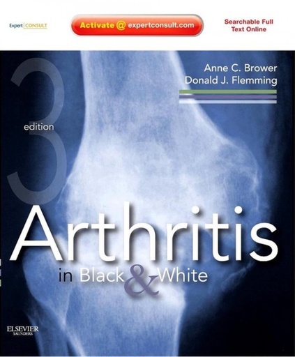 [9781416055952] Arthritis in Black and White