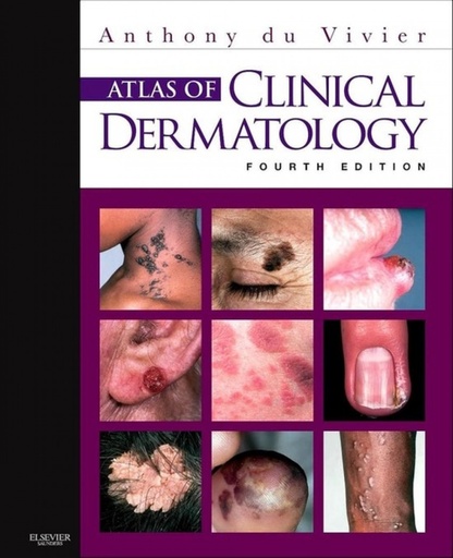 [9780702034213] Atlas of Clinical Dermatology