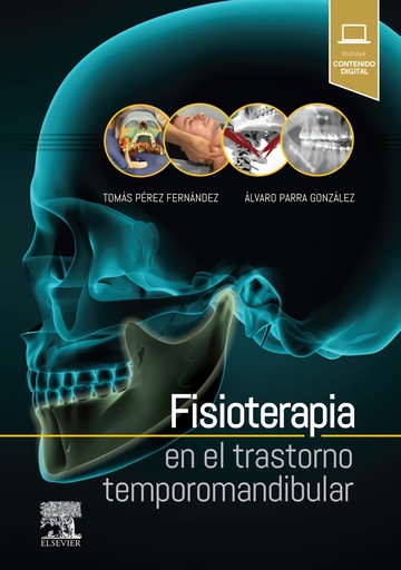 [9788491132837] FISIOTERAPIA EN EL TRASTORNO TEMPOROMANDIBULAR