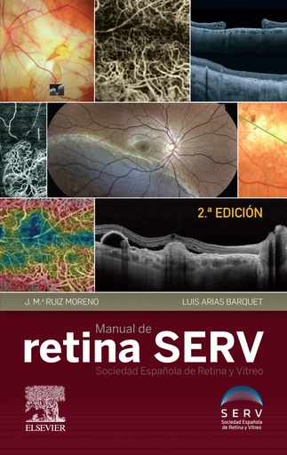 [9788491135647] MANUAL DE RETINA SERV