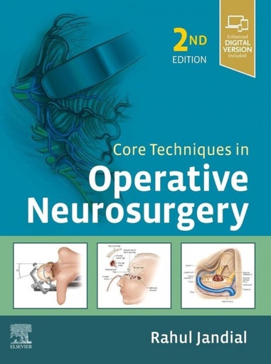 [9780323523813] CORE TECHNIQUES IN OPERATIVE NEUROSURGERY