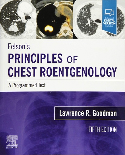 [9780323625678] FELSON´S PRINCIPLES OF CHEST ROENTGENOLOGY A PROGRAMMED