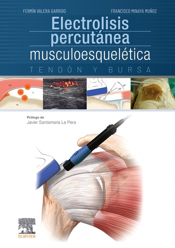 [9788491130161] Electrolisis percutánea musculoesquelética. Tendón y bursa