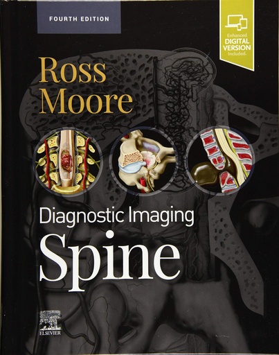 [9780323793995] Diagnostic imaging: spine