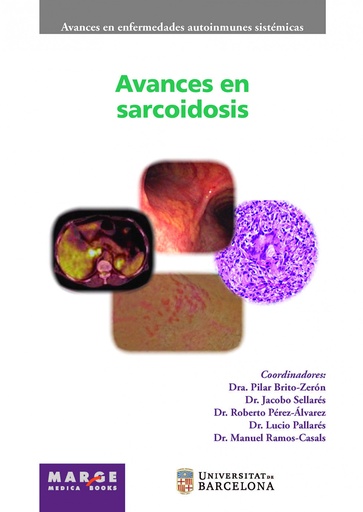 [9788417903343] Avances en sarcoidosis