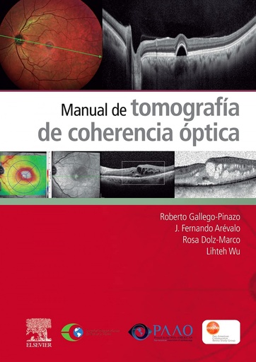 [9788491138297] Manual de tomografía de coherencia óptica