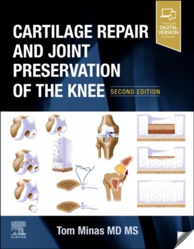 [9780323698085] Cartilage repais and joint preservation of the knee