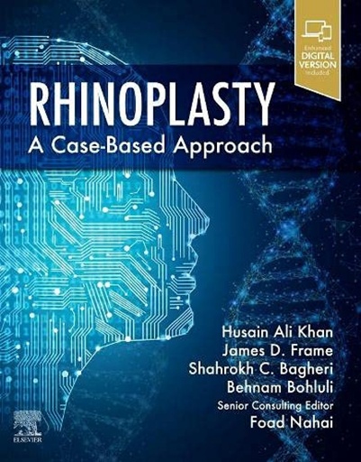 [9780323697750] RHINOPLASTY