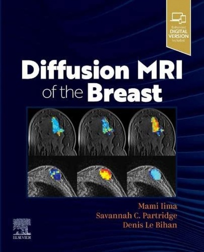 [9780323797023] DIFFUSION MRI OF THE BREAST