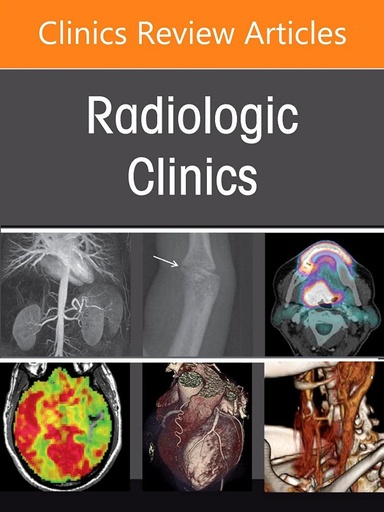 [9780323987295] IMAGING DIFFUSELUNG DISEASE ISSUE RADIOLOGIC VOL.60-6