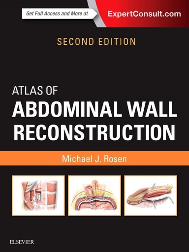 [9780323374590] Atlas of Abdominal Wall Reconstruction