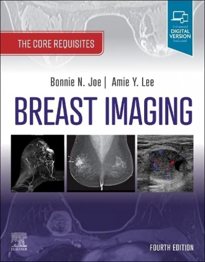 [9780323758499] Breast imaging