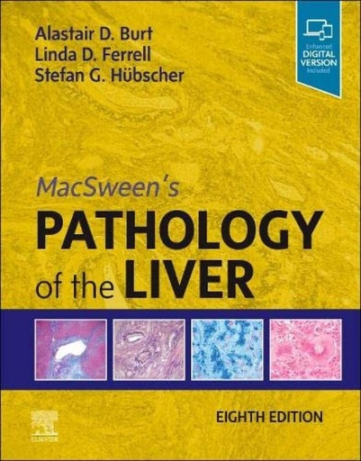 [9780702082283] Macsween´s pathology of liver